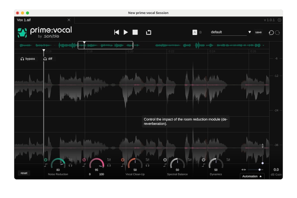 Sonible prime:vocal plug-in.